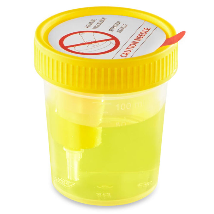 Globe Scientific 3856TP TransferTop Urine Collection Cup with Integrated Transfer Device 4oz (120mL) Graduated to 100mL STERILE Bulk Affixed Temperature Strip