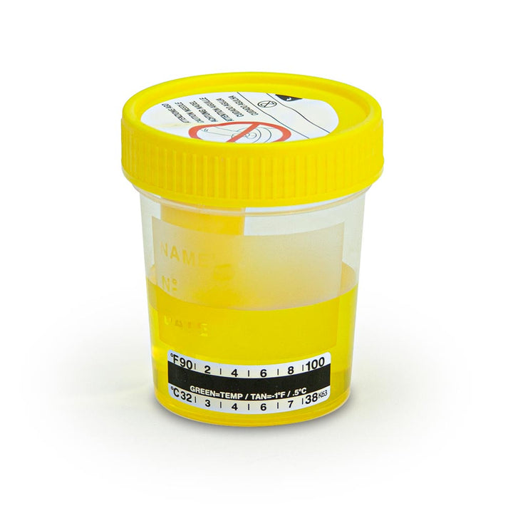 Globe Scientific 3856TP TransferTop Urine Collection Cup with Integrated Transfer Device 4oz (120mL) Graduated to 100mL STERILE Bulk Affixed Temperature Strip