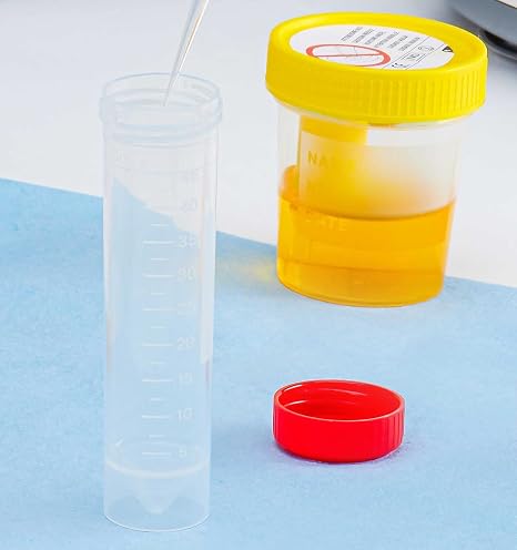 Globe Scientific 6256 Transport Tube 50mL with Attached Red Screw Cap PP Printed Graduations Conical Bottom Self-Standing STERILE 25/Bag 20 Bags/Unit