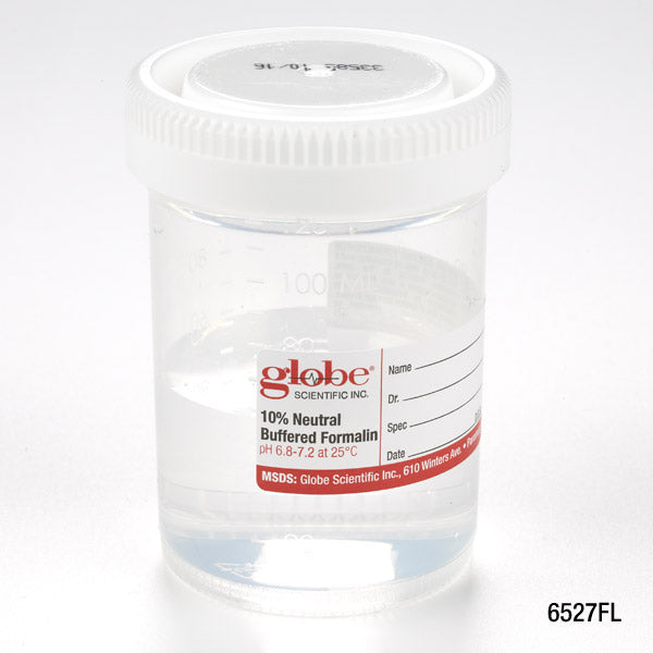 Globe Scientific 6527FL Pre-Filled Container with Click Close Lid Tite-Rite 120mL (4oz) PP Filled with 60mL of 10% Neutral Buffered Formalin Attached Hazard Label 24/Box 4 Boxes/Unit