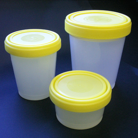 Globe Scientific 6540 Container Histology 250mL (8oz) PP Graduated with Separate Yellow Screwcap