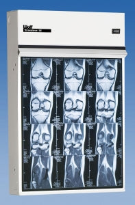 Wolf X-Ray 23401 Trimline Iii Illuminators - X-Ray Trimline Iii Illuminator, Single